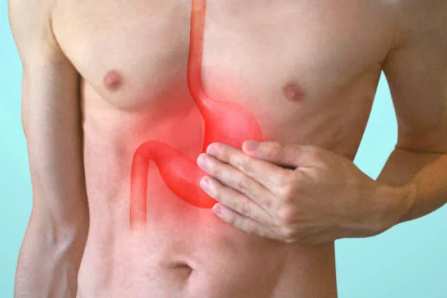 Tratamientos Naturales para la Gastritis